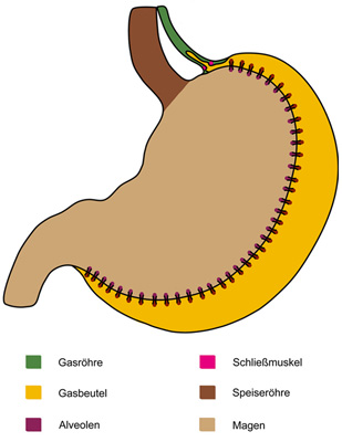 Der Gasbeutel